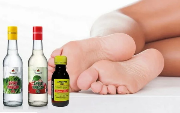 Glycerin with vinegar for cracked heels. Recipe