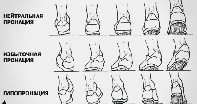 how to determine the pronation of the foot