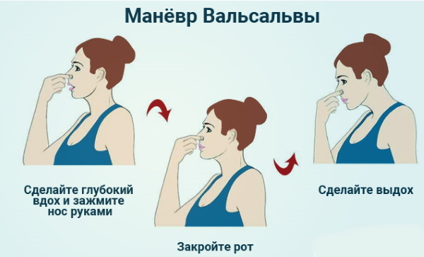 Comment enlever l'eau de votre oreille après la baignade, le bain, le rinçage du nez