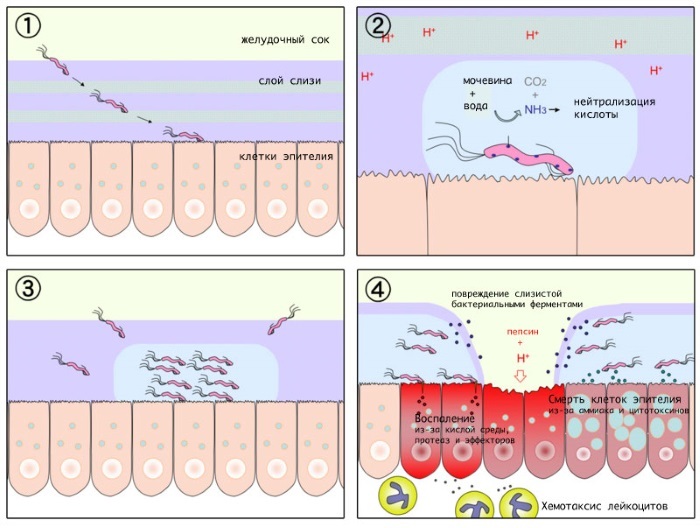 Eradication of Helicobacter pylori. Treatment regimen, clinical guidelines, drugs