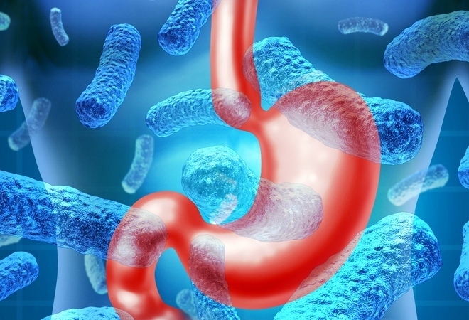 Gastrite hemorrágica: o que é, tratamento, agudo, dieta