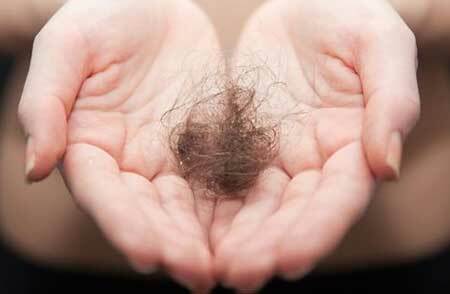 Behandeling van alopecia bij vrouwen