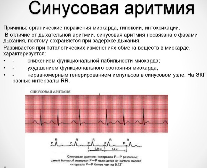 Sinuso ritmas. Moterų norma pagal amžių, EKG lentelė