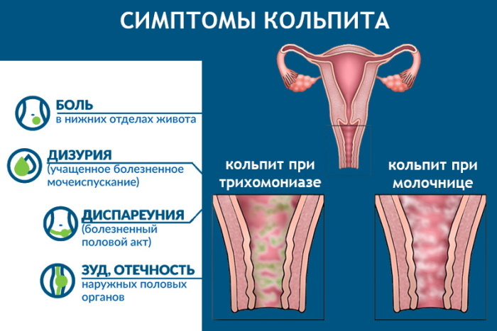 Růžový výboj uprostřed cyklu. Důvody pro užívání antikoncepce, těhotenství může