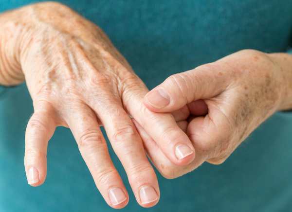 Psoriazinis artritas. Rentgeno požymiai, gydymo metodai, kas gydo, klinikinės gairės