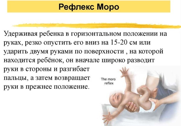 Moro refleks pri novorojenčkih, odraslih. Kaj je to, kako se znebiti