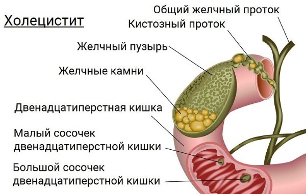 La vesícula biliar en humanos. Dónde se ubica, fotos, funciones