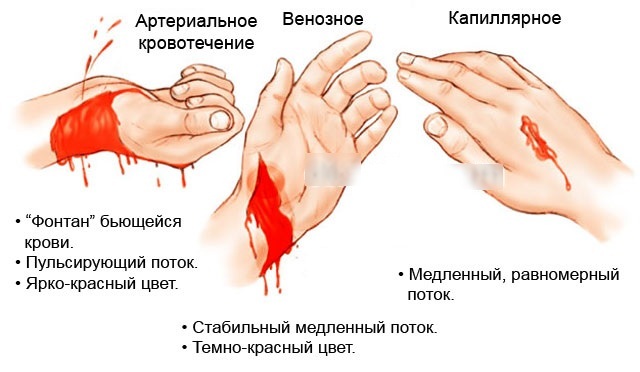 Sangrado: concepto y tipos, causas, primeros auxilios, formas de detenerlo, tratamiento