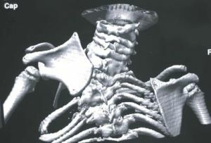 X-ray van bladen