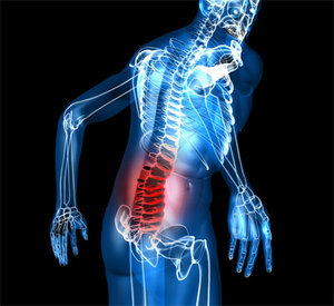 Einklemmen des Nervs im unteren Rückenbereich - wie gefährlich und wie behandeln?