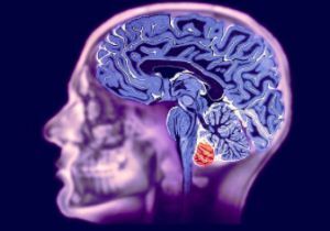 Vaskularna geneza možganov: kaj je to, simptomi in zdravljenje
