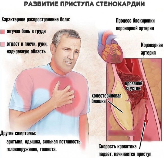 Pain in the sternum in women in the middle, right, left. Causes