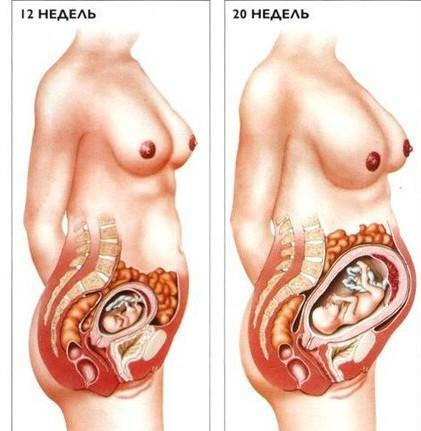 Att höja botten av livmodern orsakar tryck på de inre organen, vilket kan orsaka smärta