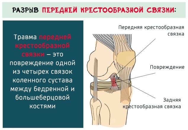 Enfermedades de la articulación de la rodilla. Síntomas, causas, tratamiento, clasificación.
