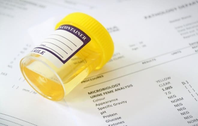 What is the level of hCG by day from conception in the urine