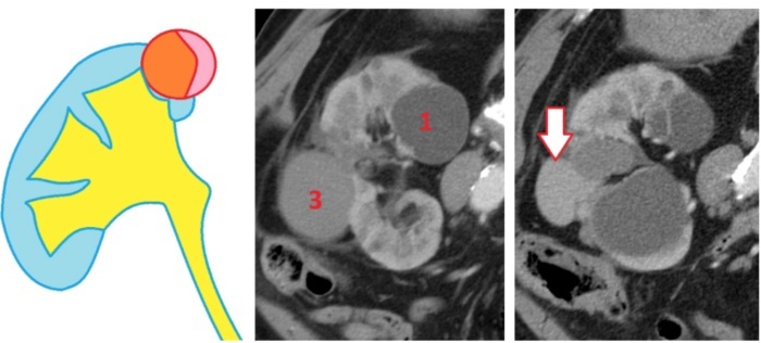 MRI of the kidneys and urinary tract. Price, which shows how it is done, preparation