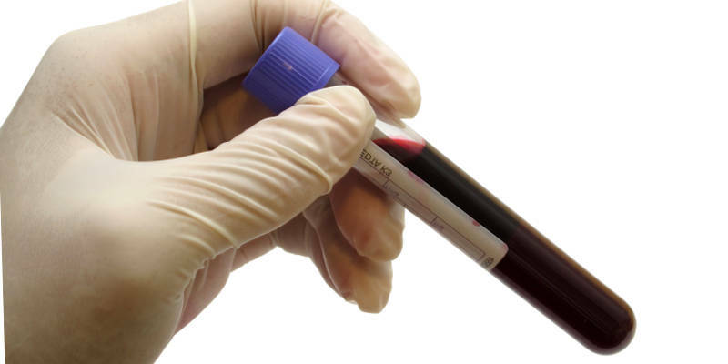 Coagulogramme du sang - quel genre d'analyse est-ce et quels sont les taux?
