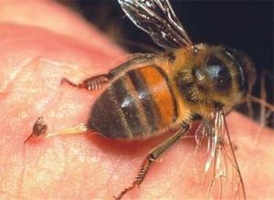 včelí bodnutí
