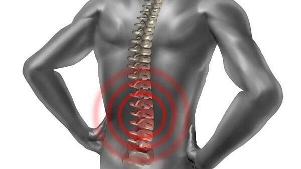 Semne ale coloanei vertebrale herniate din regiunea lombară