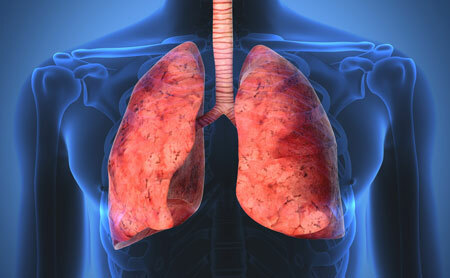 Sarcoidosis of the lungs - what is it?