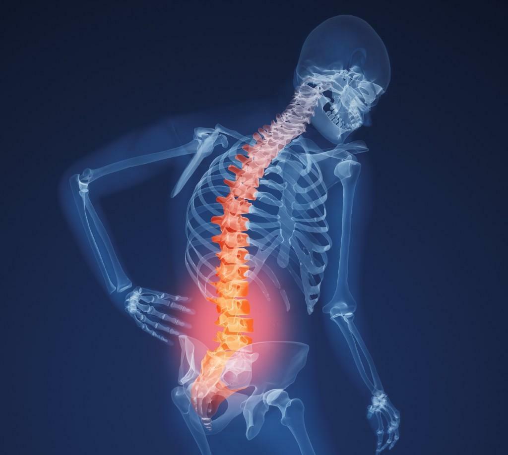 Nyeri punggung pada osteoporosis