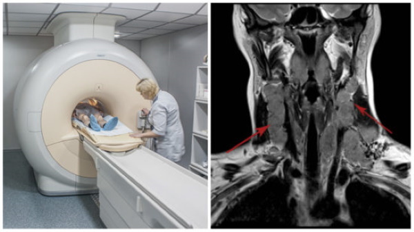 A torok és a gége, a garat, a nyelőcső MRI -je. Ami az árat mutatja
