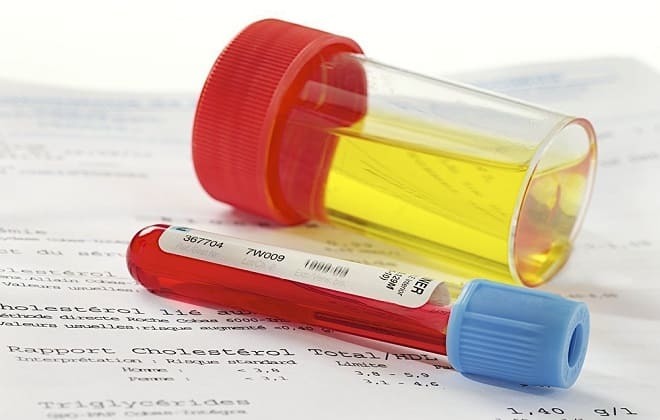 Biochemical analysis of blood and urine