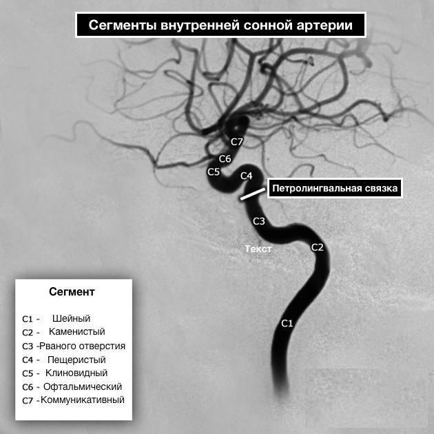 Carotid artery in humans. Where is on the neck, photo, circulation, anatomy, symptoms of diseases, ultrasound, blockage
