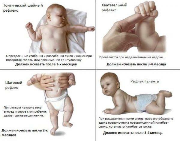 Reflexes of newborns are normal