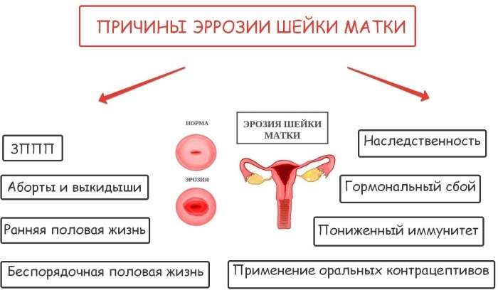 Precancerous condition of the cervix. What is it, name, treatment of 1-2-3 degrees