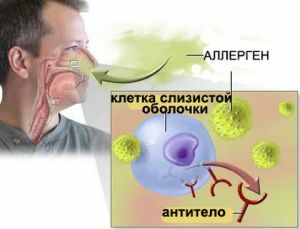 alergiju i sinusopatiju