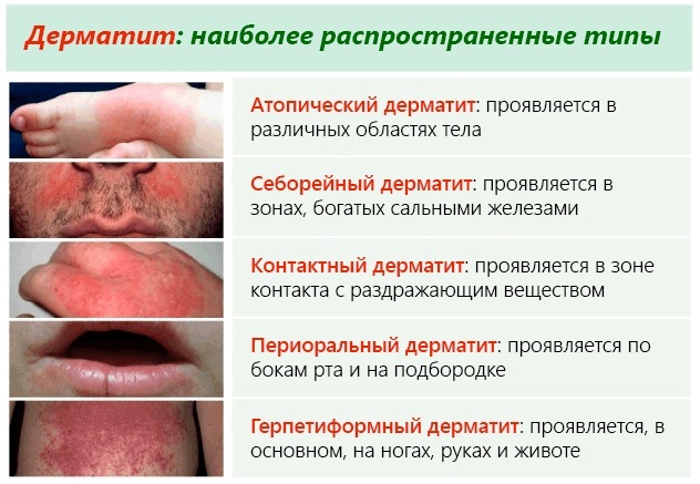 Vitaon balm Karavaev. Reviews, instructions for use for the nose, mouth, face, price
