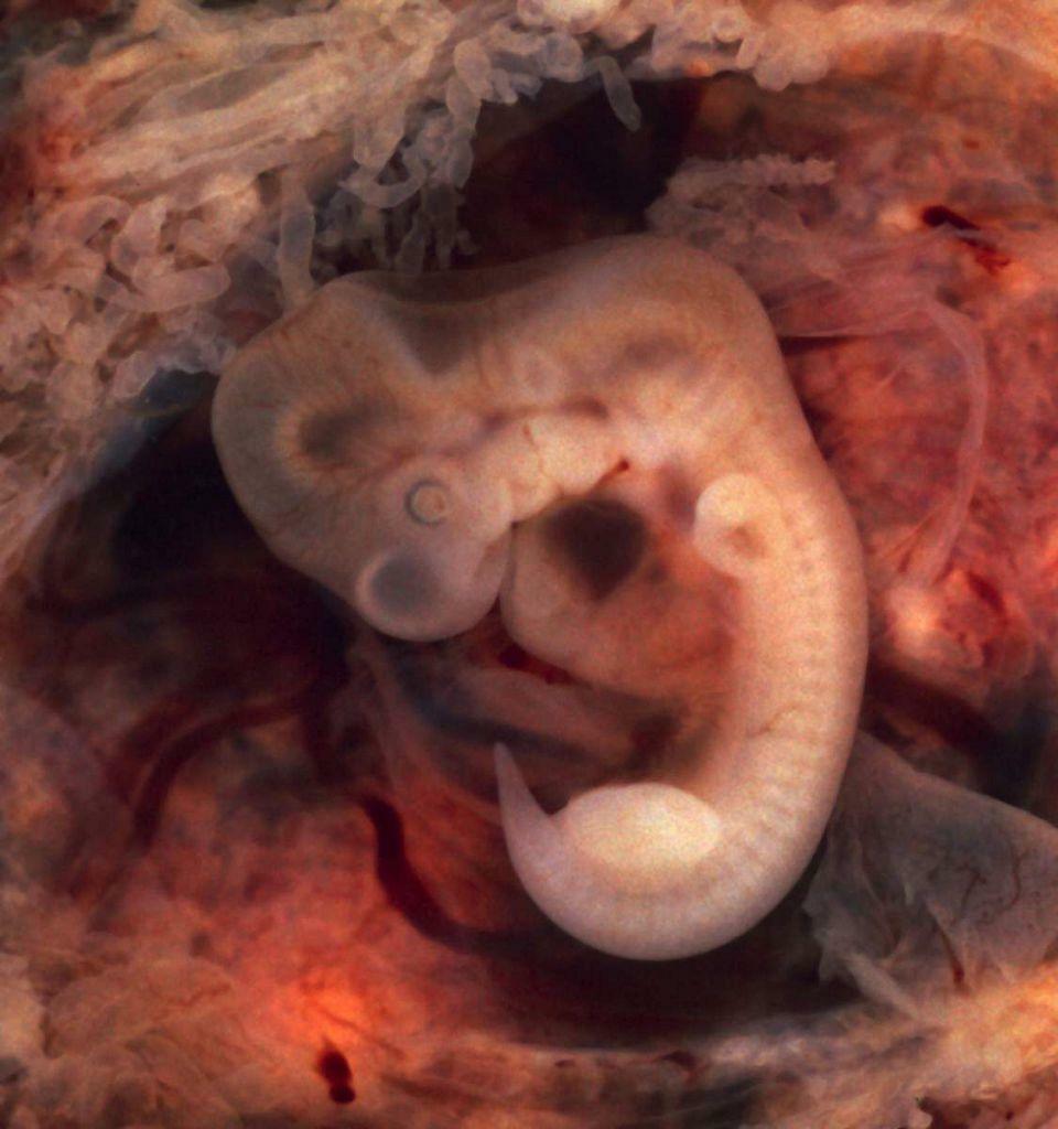 Foto af et menneskeligt embryo