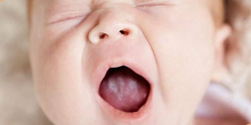 witte coating op de tong van het kind