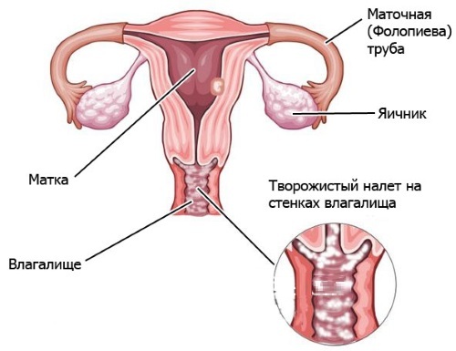 Scarico durante la menopausa nelle donne marrone, giallastro, rosso, bianco, inodore e inodore
