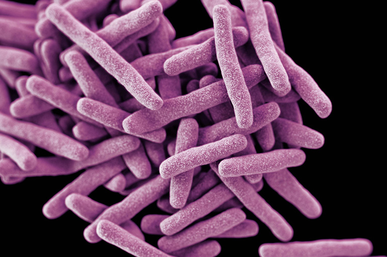 Variabilitet af mycobacterium