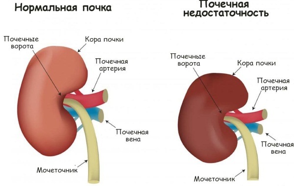 Flemoklav Solutab (Flemoclav Solutab) 1000 mg. Prijs, gebruiksaanwijzing, goedkopere analogen, beoordelingen