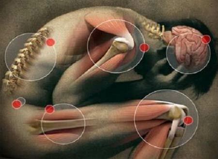 Multiple sclerosis, what is it? - Symptoms and Treatment
