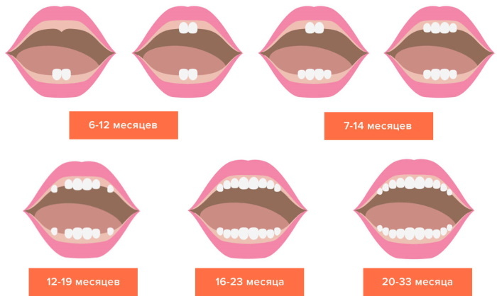 Kako nabreknejo dlesni pri zobanju pri otrocih