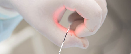 Laser treatment: the essence of the procedure