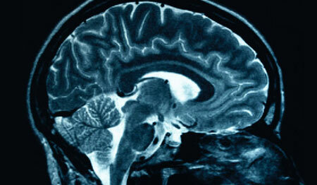 Discirculatory brain encephalopathy