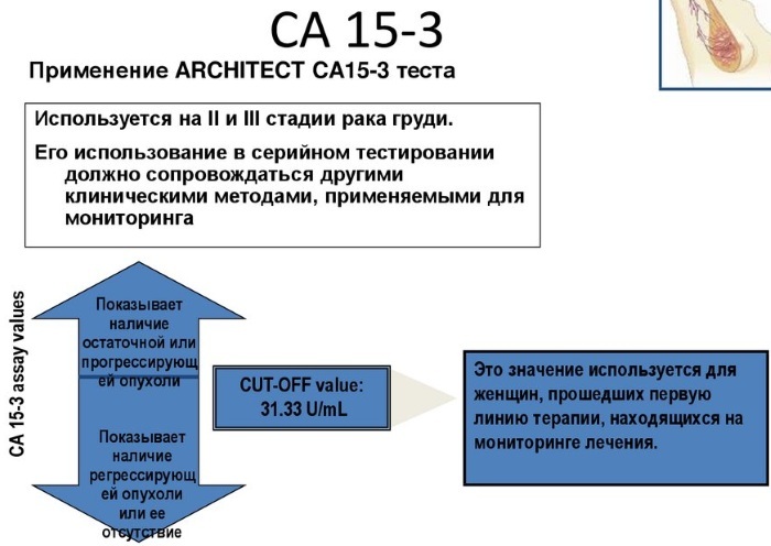 CA 15-3 tumor marker. Norm in women, table, what is it, decoding