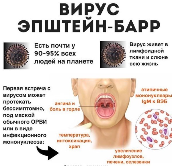 What is the Epstein-Barr virus, how to treat the symptoms of adult, child homeopathy, drugs, folk remedies