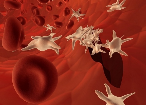 Zvýšené krvných doštičiek v krvi žien. Príčiny a liečba, čo to znamená