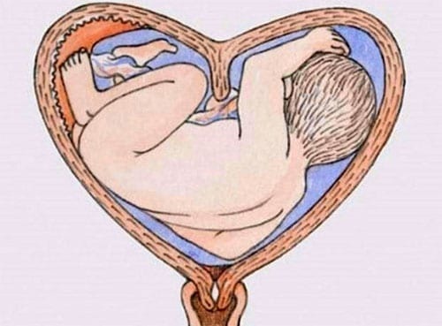 Sedlová děloha. Co to je, co to znamená během těhotenství, léčby