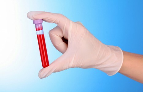 Test sanguin