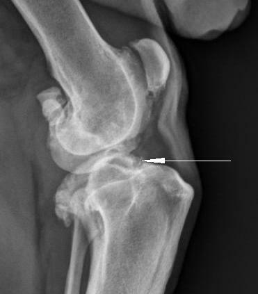The place of separation of the cruciate ligament from the surface of the large-bones