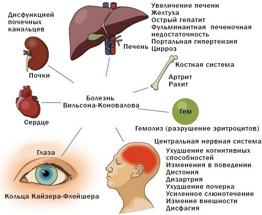Sygdomme i leveren og galdeblæren. Symptomer, behandling