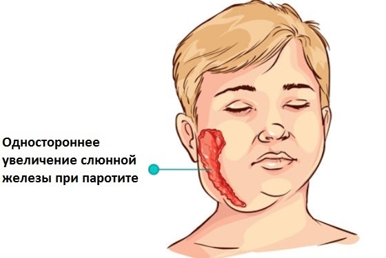 Parotid salivary gland of a person. Innervation, anatomy, histology