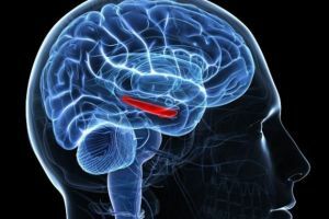 Sindrome diencefalica: un potente colpo al sistema nervoso centrale dovuto a disfunzione dell'ipotalamo